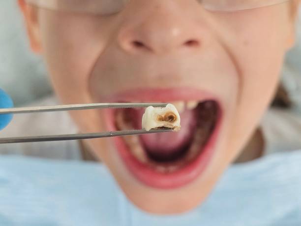 Best Pediatric Emergency Dentist in Weyauwega, WI