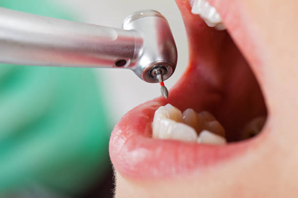 Best Urgent Care for Lost Fillings or Crowns in Weyauwega, WI